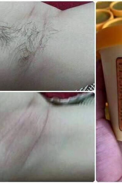 Wax lông thảo dược