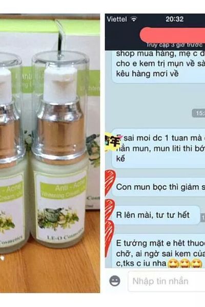 Kem trị mụn anti - acnes