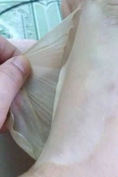 Lột nước trắng da collagen