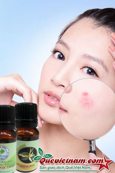 Tinh dầu ngọc lan tây